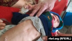 په خوارځواکۍ یو اخته ماشوم 