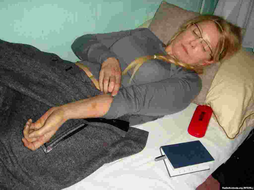 Julija Timošenko pokazuje modrice zbog navodnog zanemarivanja u zatvoru 2012, godine